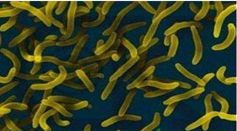 微生物菌劑好？好在哪里您知道嗎？